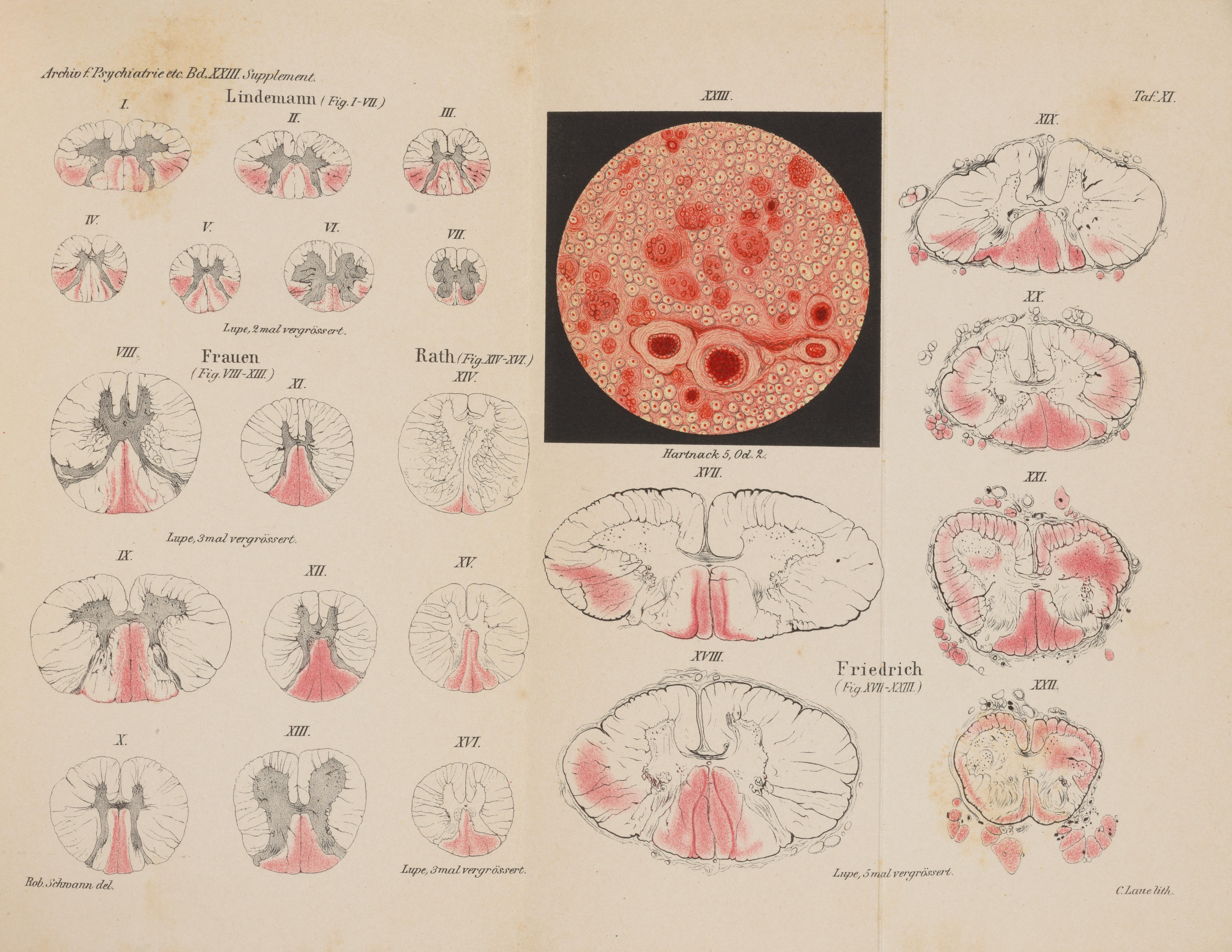 Appraisal: EYE SURGERY titles ALLBUTT THOMAS CLIFFORD - On the use