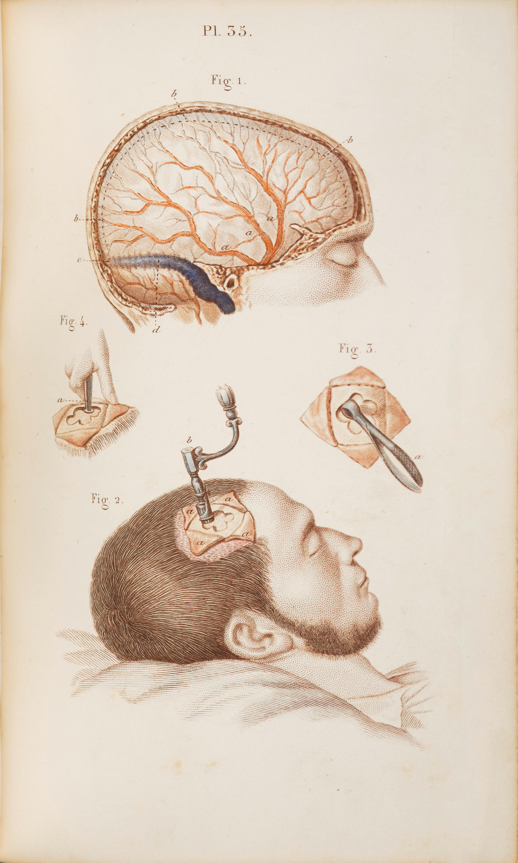 Appraisal: BERNARD CLAUDE - AND CHARLES HUETTE Precis iconographique de medecine