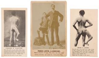 Appraisal: Francis Lentini -Legged Boy Sideshow Cabinet Card Philadelphia Edena Studio