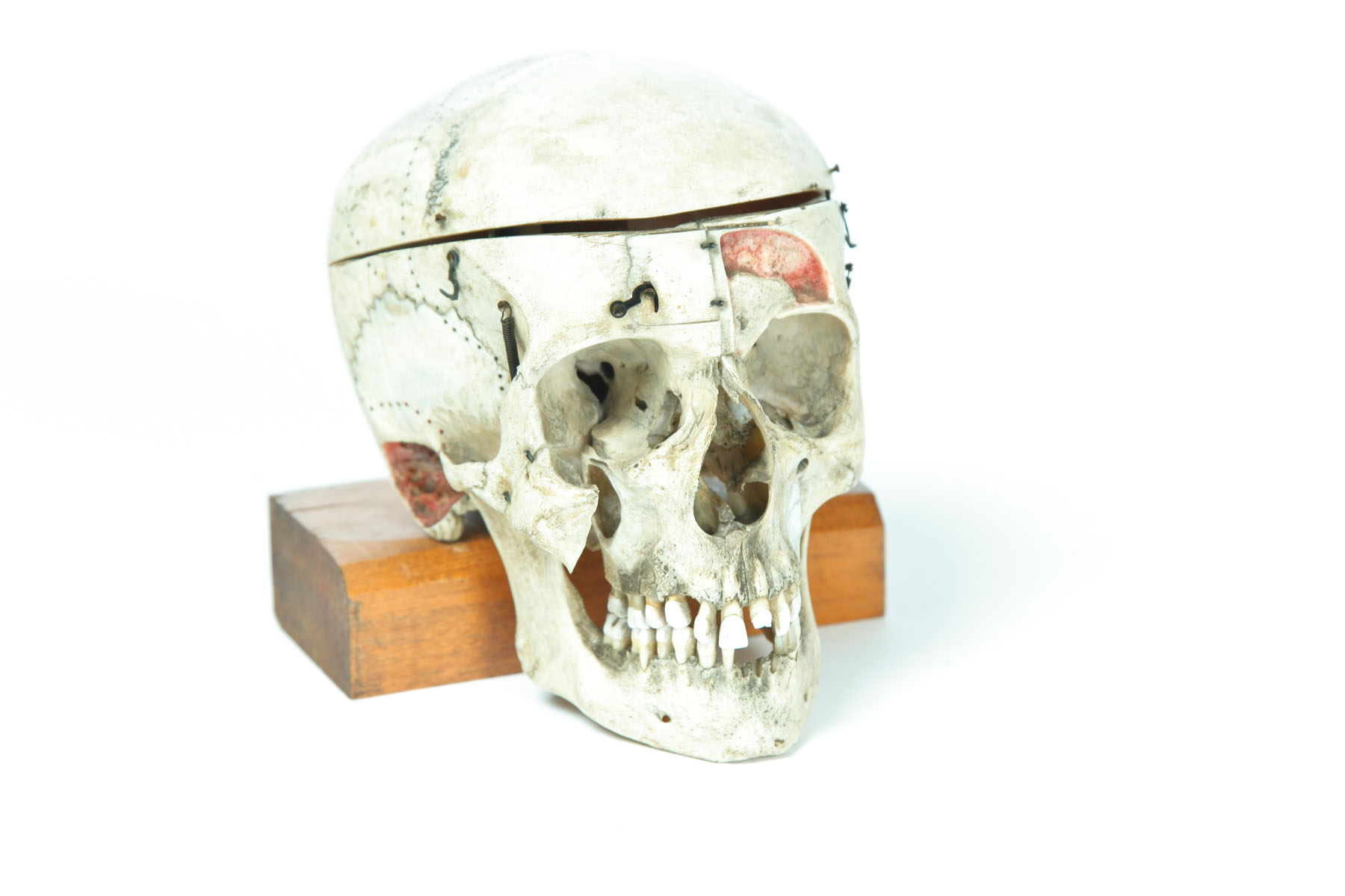 Appraisal: TEACHING SPECIMEN Late th-early th century Skull with cut away