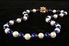 Appraisal: NECKLACE - String of mm pearls and mm lapis beads