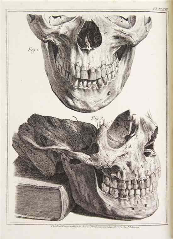 Appraisal: HUNTER JOHN The Natural History of the Human Teeth Explaining