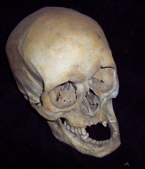 Appraisal: A human skull