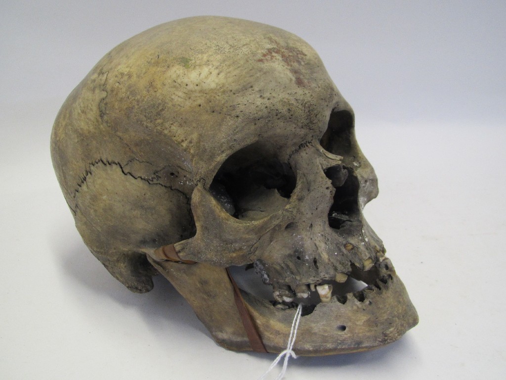 Appraisal: Human skull - from William Crosbie's estate probably used for