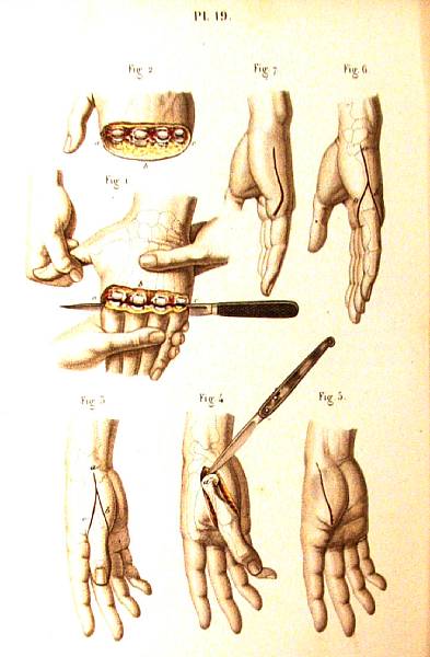 Appraisal: BERNARD CLAUDE and HUETTE CHARLES Precis iconographique de medicine operatoire