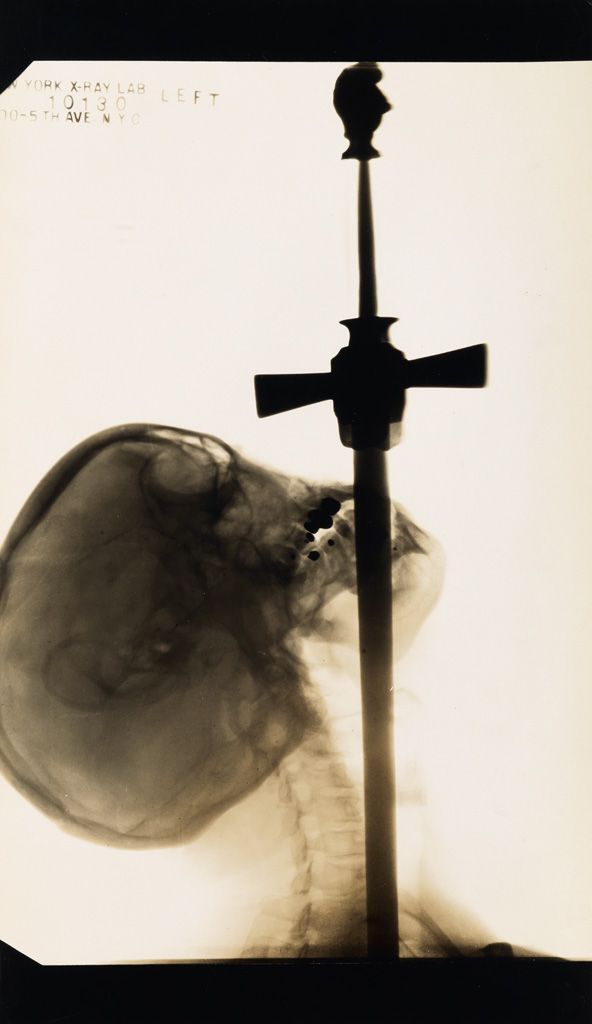 Appraisal: KELTY EDWARD J - X-ray of Ajax the sword swallower