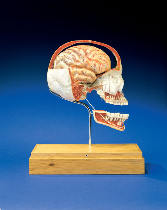 Appraisal: MEDICAL HUMAN DEMONSTRATION SKULL This special medical dissection is of