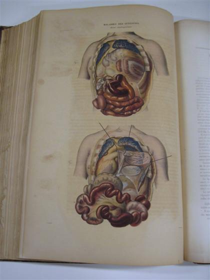 Appraisal: vols portfolio Cruveilheir Jean Anatomie Pathologique du Corps Humain Paris