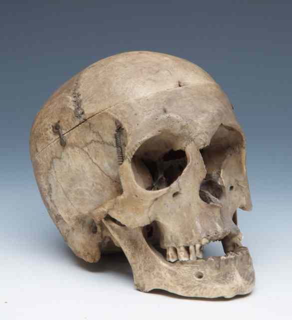 Appraisal: A TH CENTURY HUMAN SKULL the jaw sprung and cranium