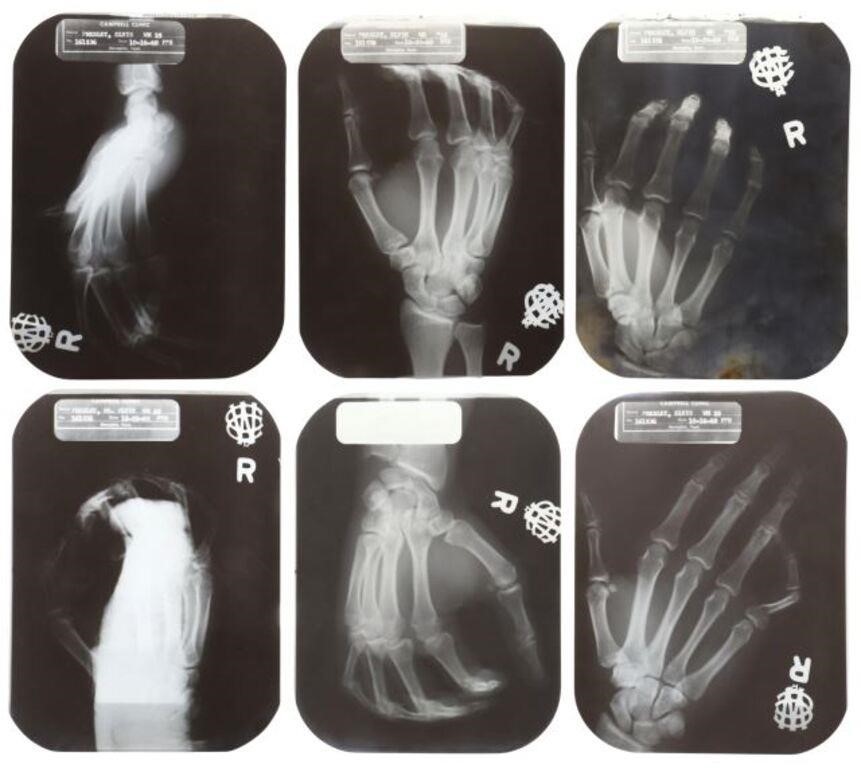 Appraisal: lot of Elvis Presley X-rays taken October at the Campbell