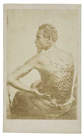 Appraisal: SLAVERY AND ABOLITION--PHOTOGRAPHY The Scourged Back Carte-de-visite of Private Gordon