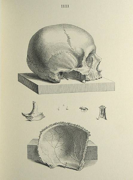 Appraisal: CHESELDEN WILLIAM Osteographia or the Anatomy of the Bones Philadelphia