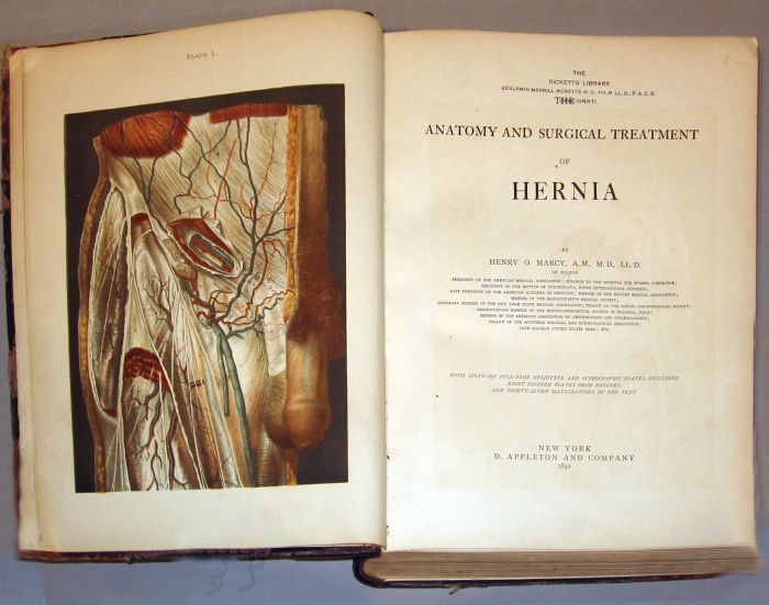 Appraisal: vol Marcy Henry O Anatomy and Surgical Treatment of Hernia