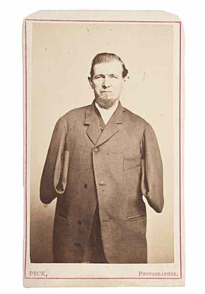 Appraisal: Gettysburg Amputee Private George Warner CDV Albumen portrait of George