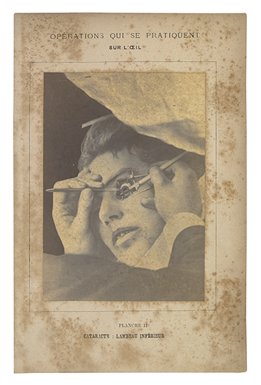 Appraisal: FIRST PHOTOGRAPHICALLY-ILLUSTRATED BOOK ON OPHTHALMIC SURGERY MEYER DOUARD and MONTM