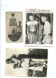 Appraisal: Group of Four Photos of Alligator or Elephant Skinned People