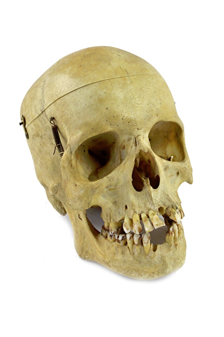 Appraisal: A female half skeleton affectionately known as 'Genevieve' in a