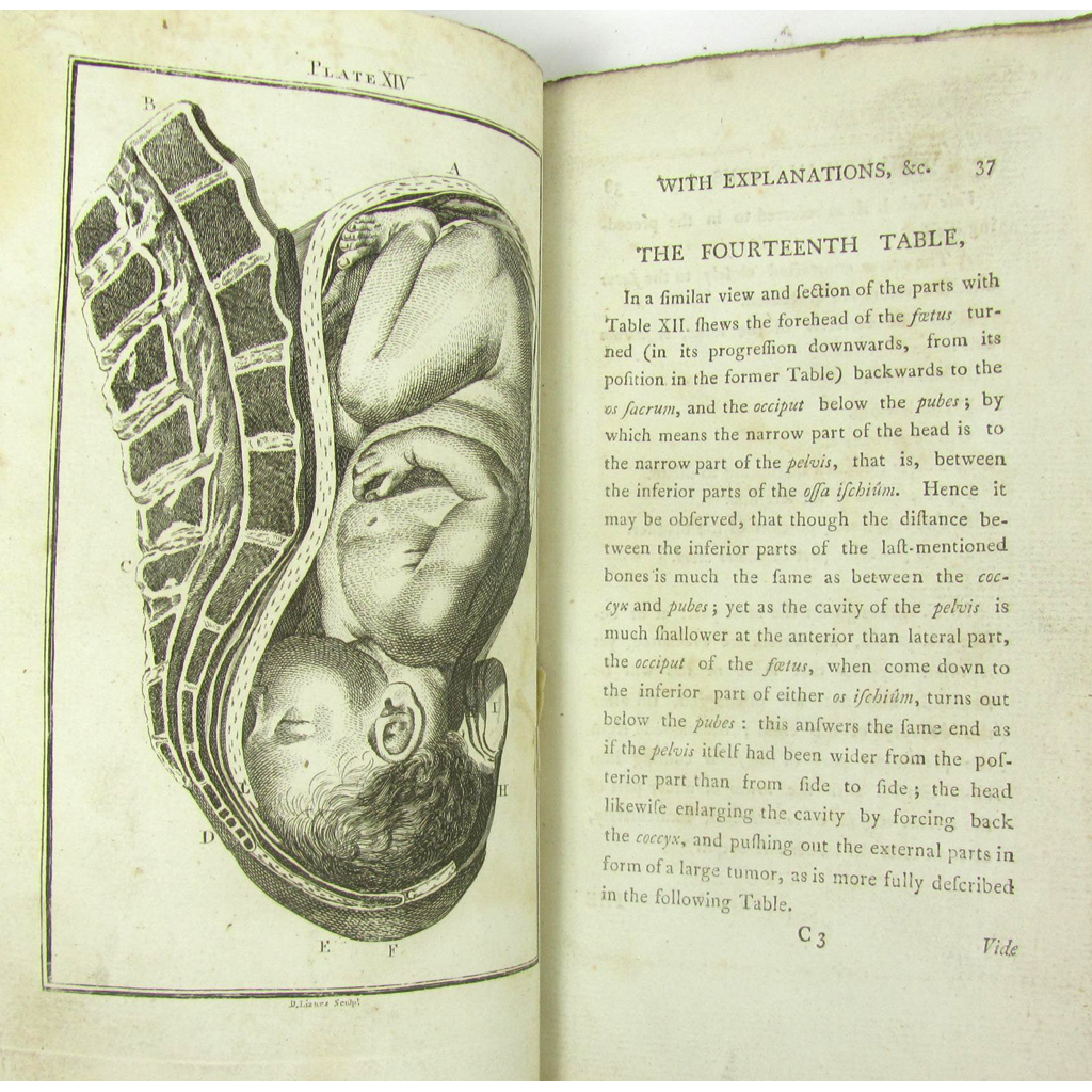 Appraisal: Smellie WilliamA set of Anatomical Tables with Explanations and an