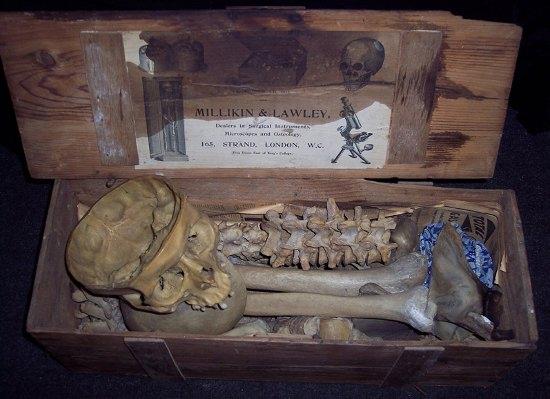 Appraisal: A human skeleton contained in a box labelled Millikin Lawley