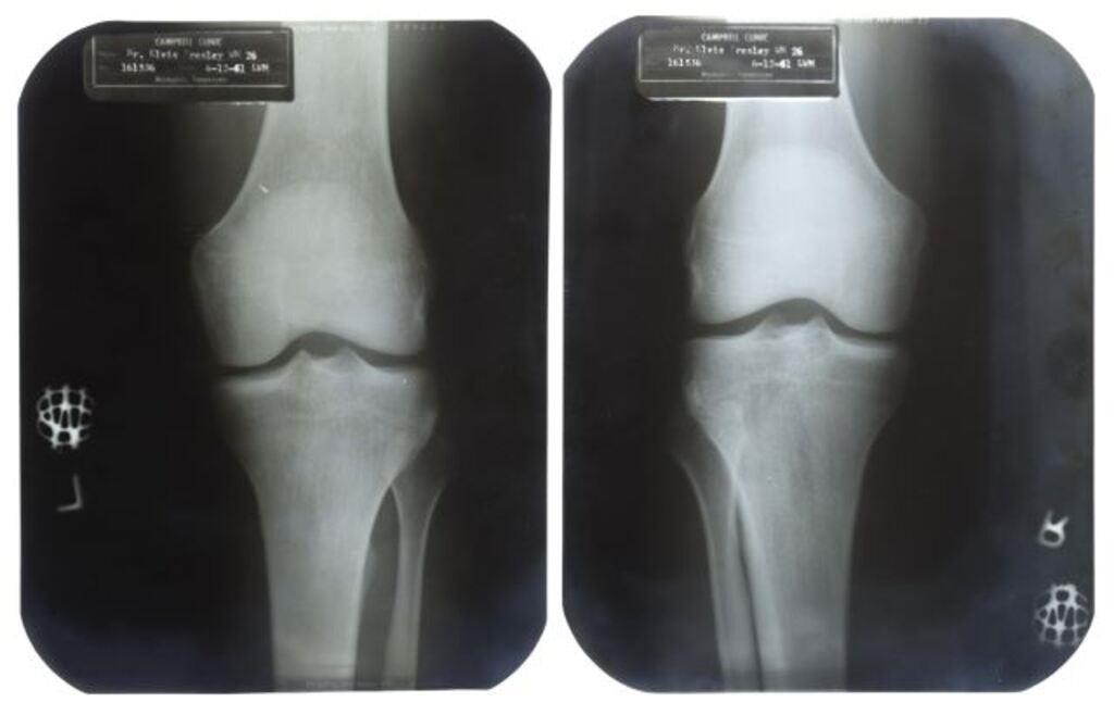 Appraisal: lot of Elvis Presley X-rays taken June at the Campbell