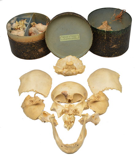 Appraisal: A LATE TH CENTURY MILLIKIN AND LAWLEY ANATOMICAL SPECIMEN OF