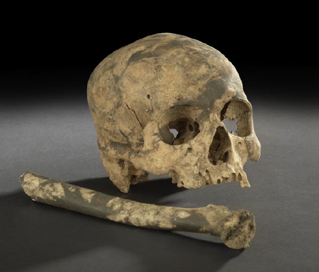 Appraisal: Charred Human Skull and Femur of unknown origin the skull