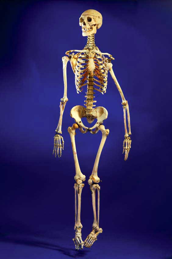 Appraisal: ANTIQUE HUMAN SKELETON Homo sapiens This lot includes a natural