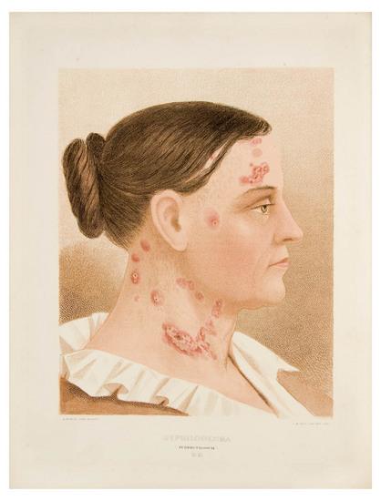 Appraisal: MEDICINE - DURHRING Louis A Atlas of Skin Diseases Philadelphia