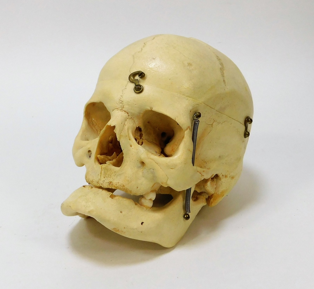 Appraisal: AUTHENTIC MEDICAL STUDENT STUDY HUMAN BONE SKULL United States th