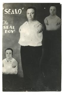 Appraisal: Sealo the Seal Boy Sideshow Photograph Frankfort Ind Kobel Feature