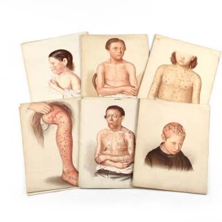 Appraisal: Plates From Jonathan Hutchinson's Atlas of Skin Diseases London New