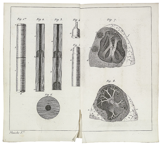 Appraisal: LAENNEC REN -TH OPHILE-HYACINTHE Trait de l'Auscultation M diate et